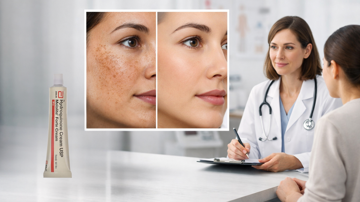 Melalite Forte cream showing improvement in dark spots and uneven skin tone